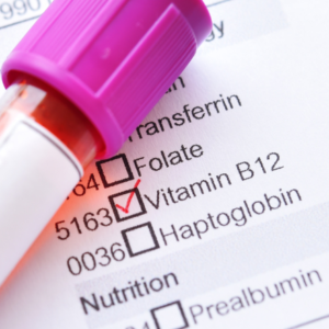 EXAME DE VITAMINA B12
