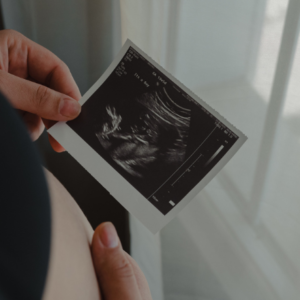 TESTE DE IDENTIFICAÇÃO DO SEXO DO BEBÊ